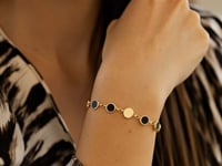 External Video
